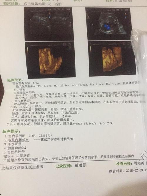 二十四周,岁月流转中的生活轨迹与感悟”